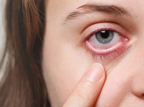 Gejala Retinoblastoma pada Anak yang Perlu Diwaspadai