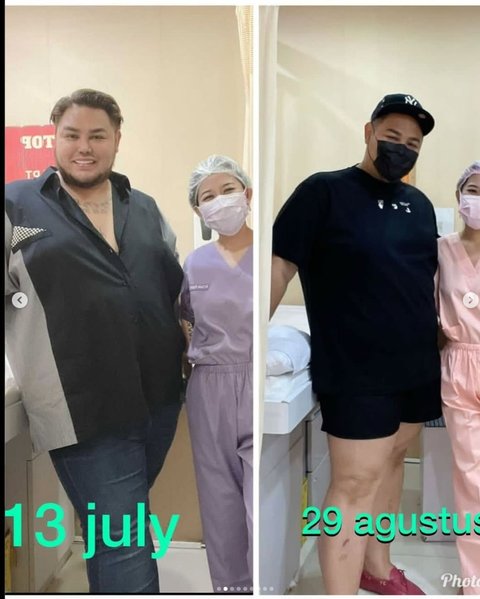 Ivan Gunawan Bagikan Potret Transformasi Sebelum dan Sesudah Diet, Netizen Sebut Sekarang Makin Gagah dan Tampan