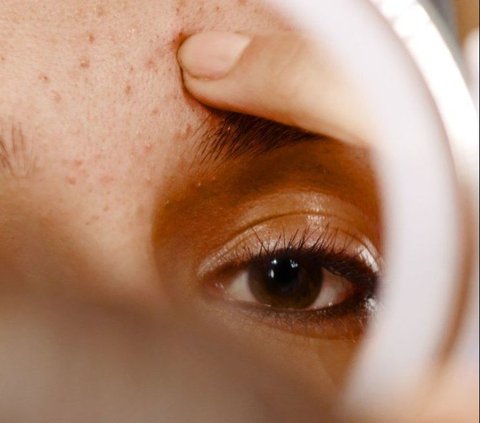 Apakah Remaja Boleh Memakai Skincare? Bagaimana Cara Pakai dan Memilihnya?