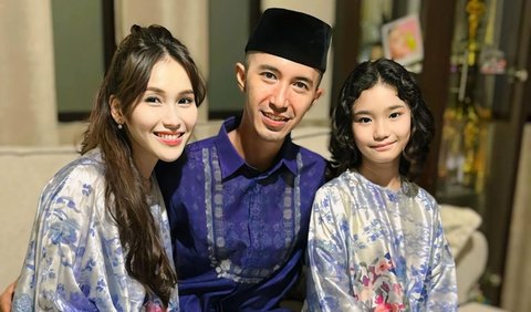 Ayu Ting Ting sempat mengunggah potret kebersamaan dengan sang calon suami, Lettu Muhammad Fardana.<br>