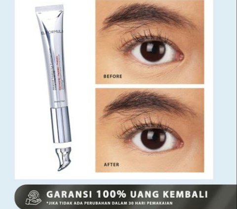 10 Best Eye Cream Recommendations to Remove Dark Circles Edition 2024