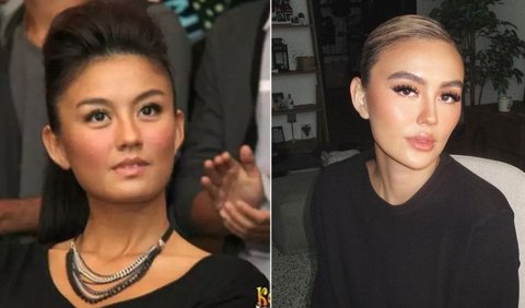 <b>Agnez Mo</b>