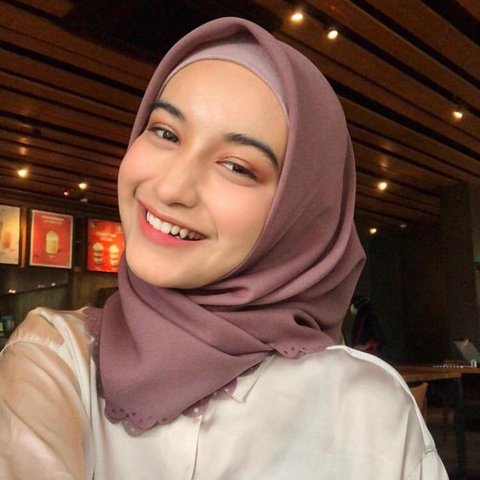 Potret Dulu dan Kini Cut Intan Nabila, Selebgram sekaligus Mantan Atlet Anggar yang Jadi Korban KDRT