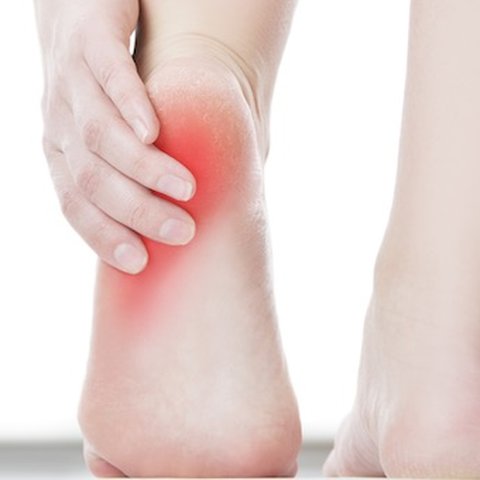 Mengalahkan Plantar Fasciitis: Tips dan Cara Penyembuhan yang Terbukti Ampuh