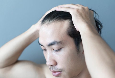 Menyuburkan Rambut Pria yang Tipis Bisa Dimulai dari Langkah Ini! Apa Saja?