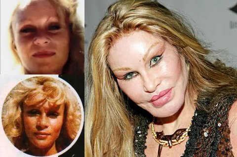 Jocelyn Wildenstein 'Catwoman', Sosialita Asal Swiss Sekaligus Penggila Operasi Plastik Dikabarkan Meninggal Dunia