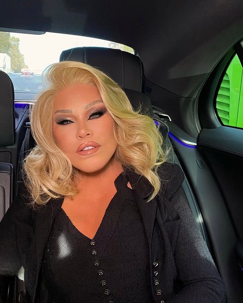 Jocelyn Wildenstein, 'Catwoman' dan Sosialita Asal Swiss Meninggal Dunia di Usia 84 Tahun