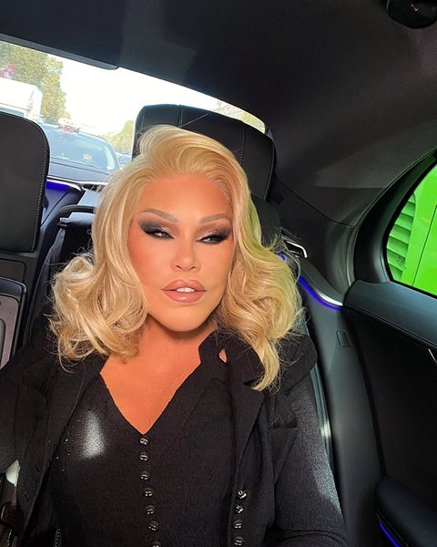 Jocelyn Wildenstein, 'Catwoman' dan Sosialita Asal Swiss Meninggal Dunia di Usia 84 Tahun