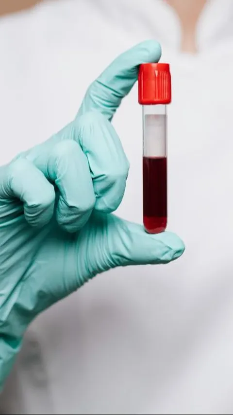 Cara Mengetahui Golongan Darah yang Mudah dan Praktis