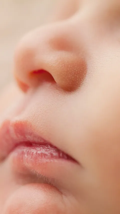Penyebab Bibir Kering pada Anak, Begini Cara Mengatasinya