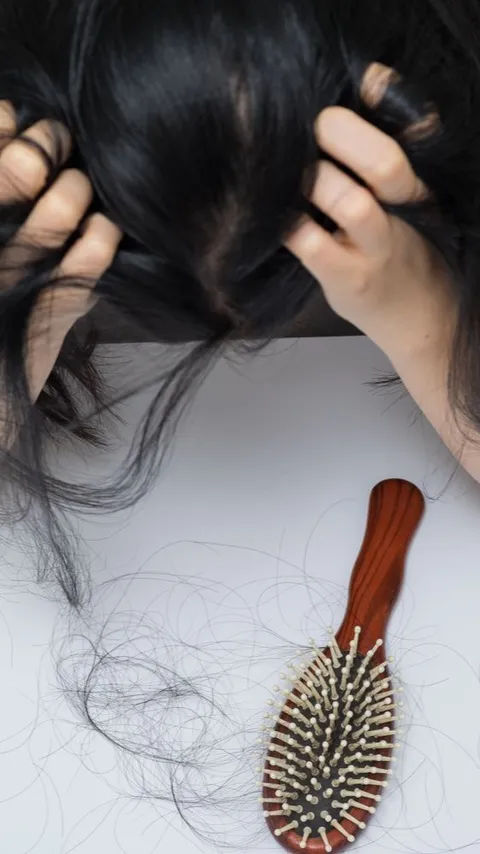 Rambut Rontok Ternyata Tak Cukup Diatasi Pakai Sampo Saja, Solusinya?
