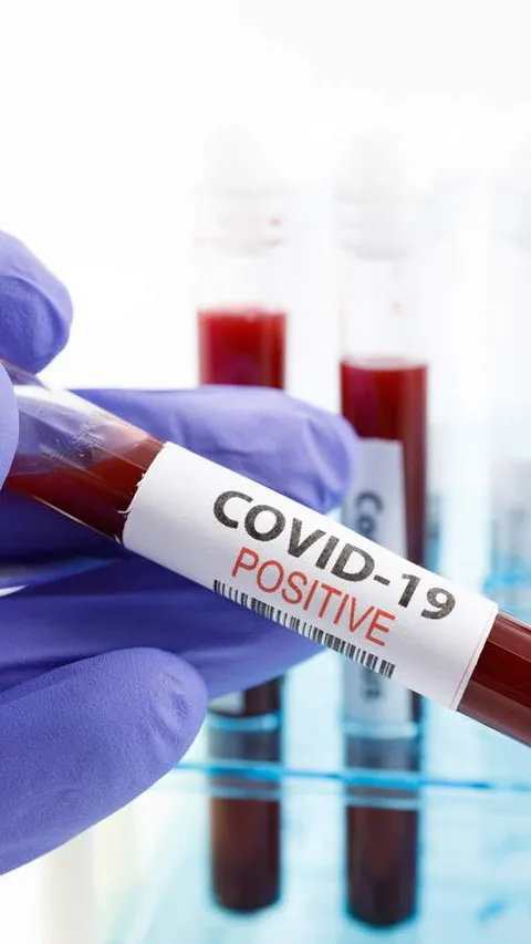 Sejarah 2 Maret: Kasus Pertama Virus Covid-19 di Indonesia