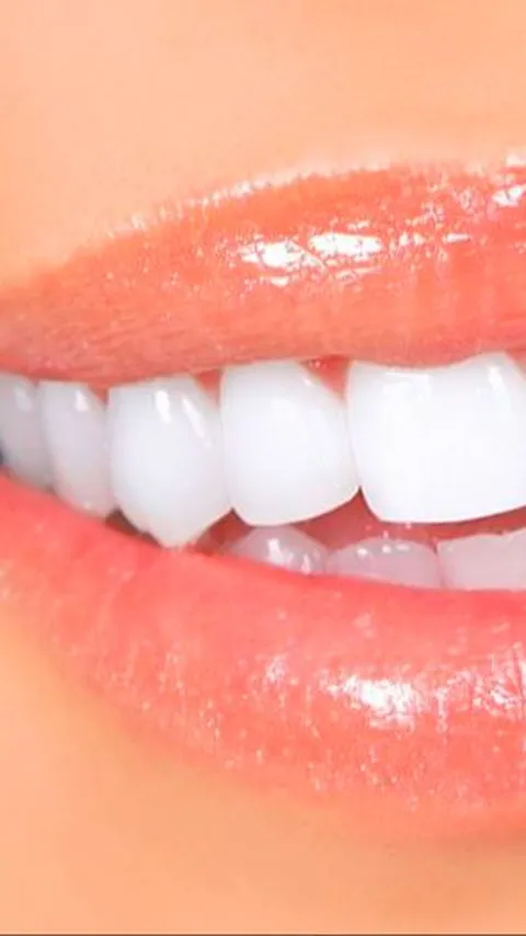 Cara Memutihkan Gigi Kuning dengan Ampuh dan Alami, Cukup Pakai 2 Bahan Ini
