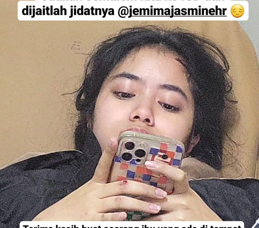 Putri Cantik Novita Angie Jatuh di Eskalator dan Dilarikan ke RS, Begini Kondisinya