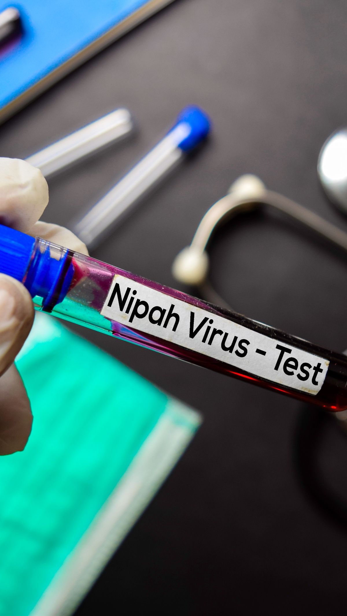 Bahaya Virus Nipah, Asal Usul dan Efek Mematikannya pada Manusia