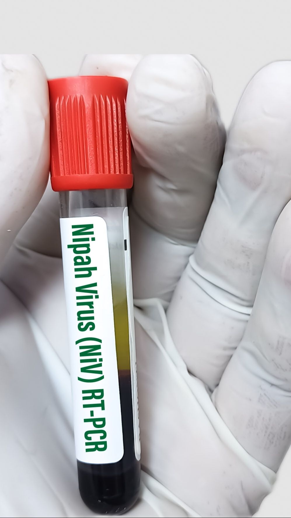 Bahaya Virus Nipah, Kisah Nyata Kerala di 2018 dalam Film “Virus”