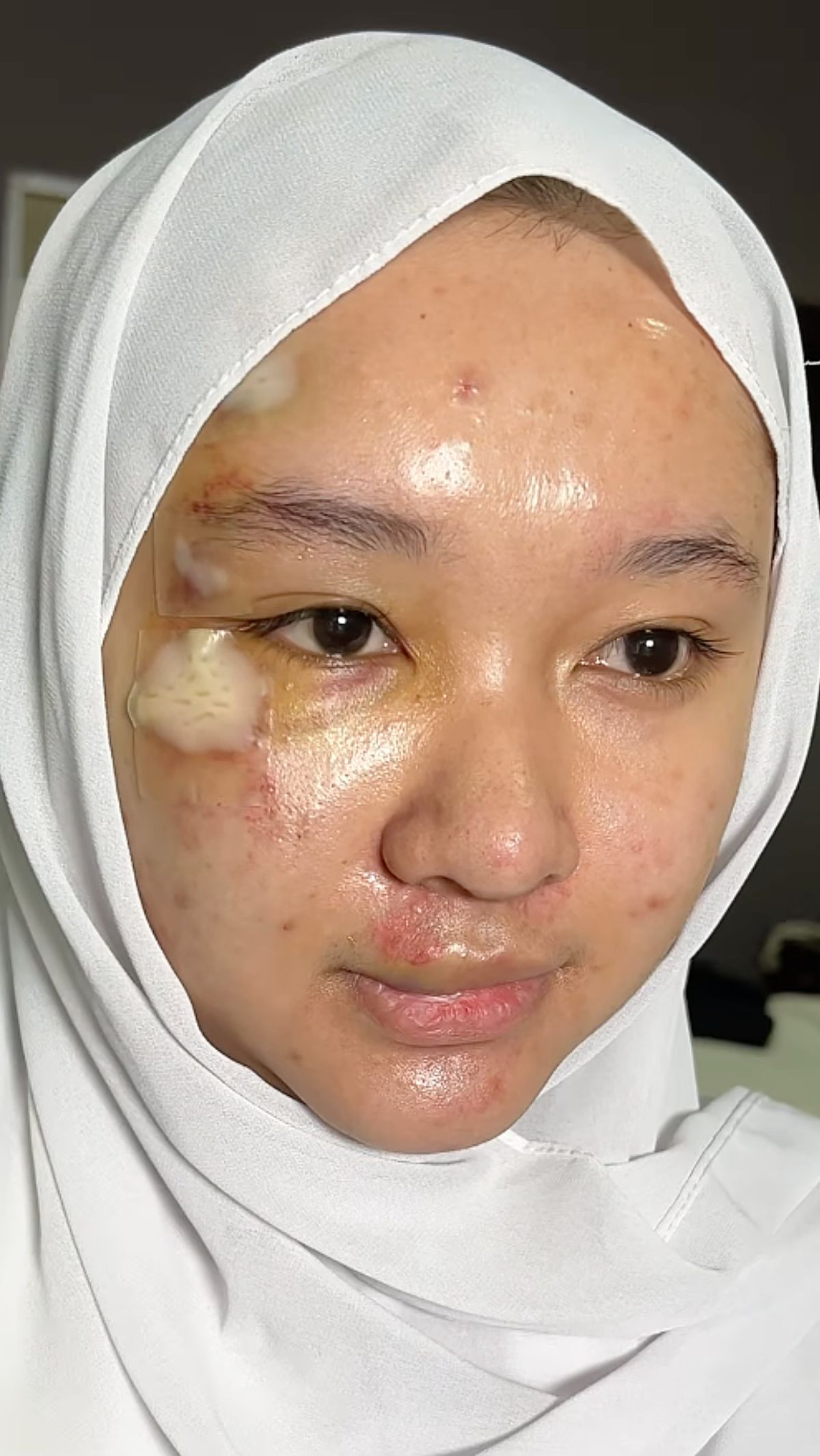 Wajah Pengantin Terluka Akibat Kecelakaan Jelang Pernikahan, Hasil Riasan MUA Bikin Takjub