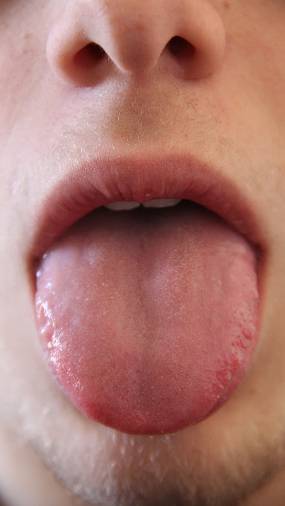 <b>Tanda Diabetes yang Muncul di Mulut, Wajib Diwaspadai</b>