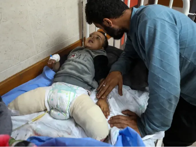 Kisah Pilu Bocah Tiga Tahun di Gaza, Bom Israel Renggut Semua Keluarganya dan Kini Harus Hidup Tanpa Kaki