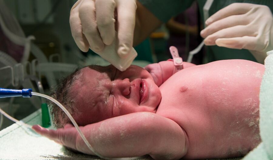 3. Masalah Pernapasan: Beberapa kasus melaporkan masalah pernapasan pada bayi setelah lahir, meskipun masih dalam perdebatan ilmiah.