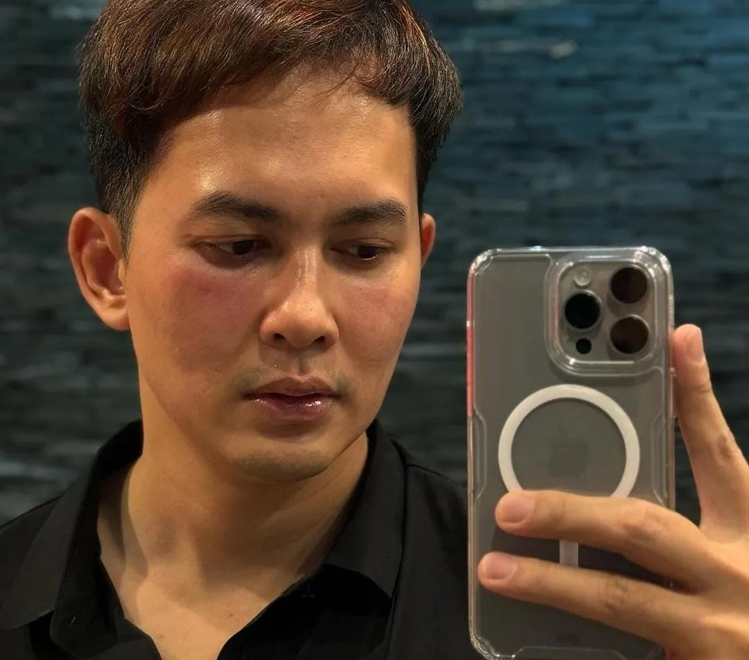9 Potret Terbaru Kiki Farrel Dibully Netizen Karena Wajah Dinilai Beda Banget