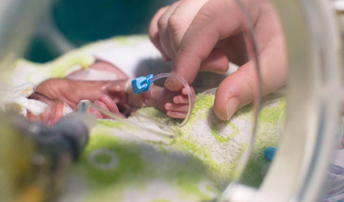 Kondisi lemah bayi prematur Gaza