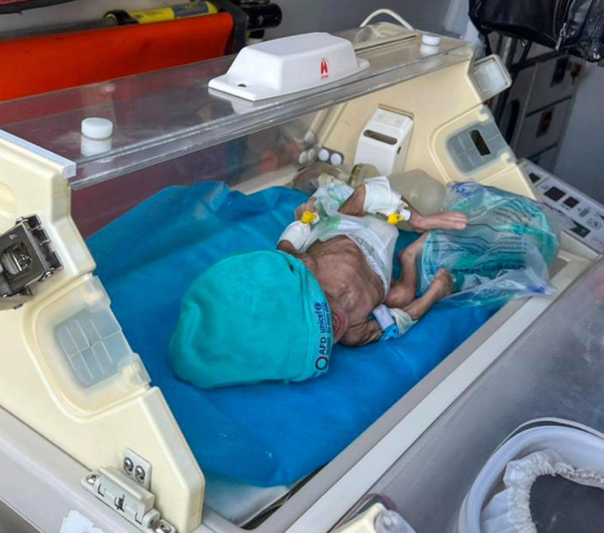 FOTO: Potret Puluhan Bayi Prematur Tanpa Orang Tua Dievakuasi dari RS Al-Shifa Gaza ke Mesir