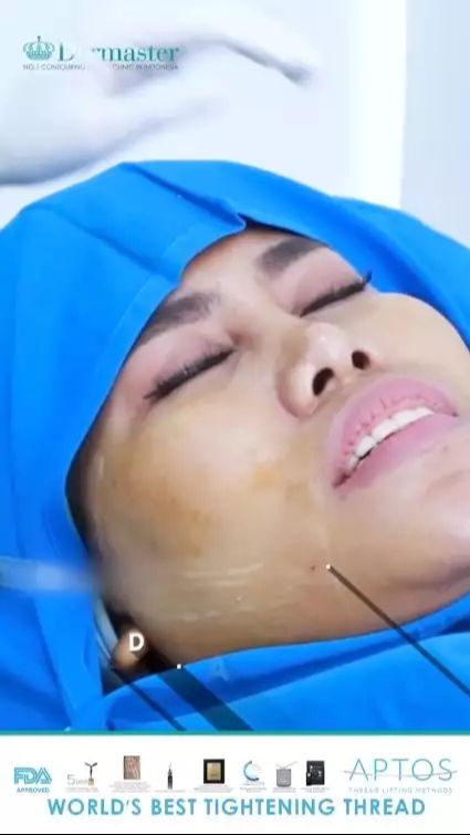 Di usianya yang menginjak 30 tahun, Evi Masamba sepertinya fokus untuk melakukan treatment yang bisa membuat kulitnya lebih kencang dan terlihat awet muda.