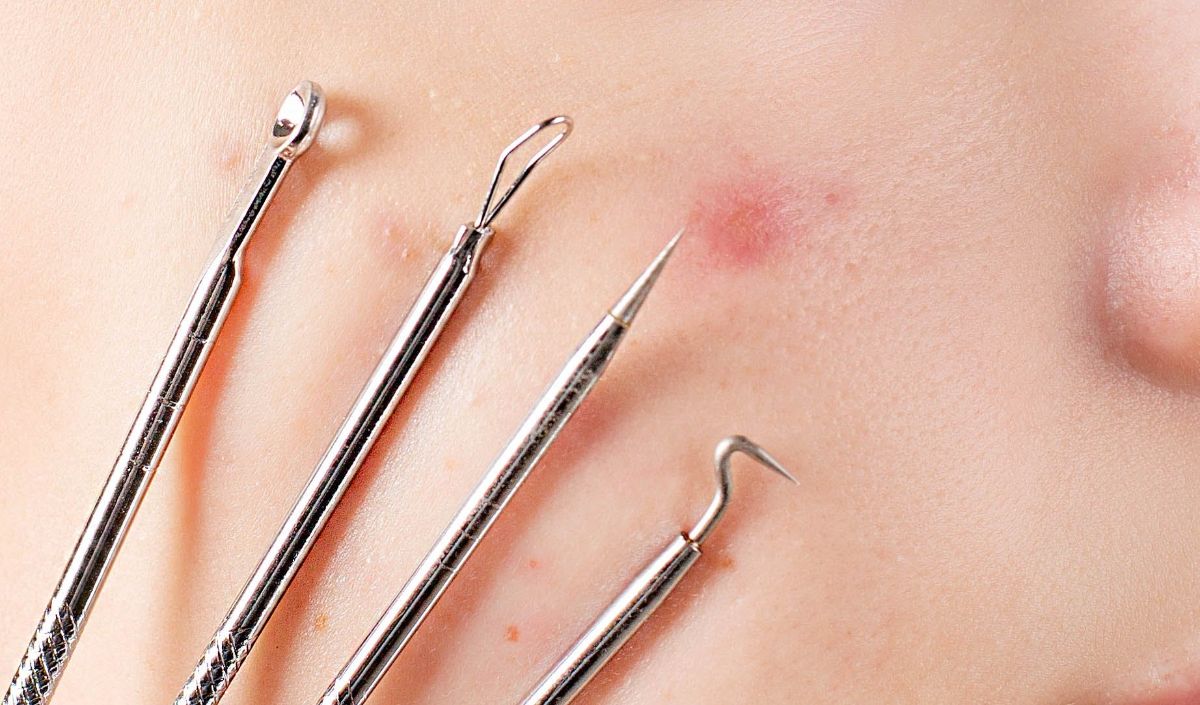 3. Hindari Ekstrasi Pada Facial Pertama