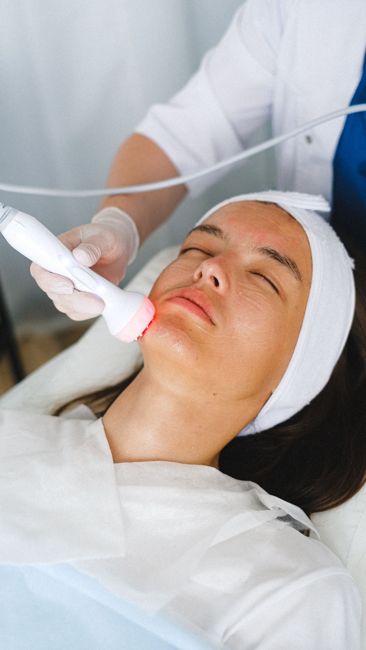 Kulit Breakout Pasca Facial? Jangan Panik, Ini Cara Mengatasinya