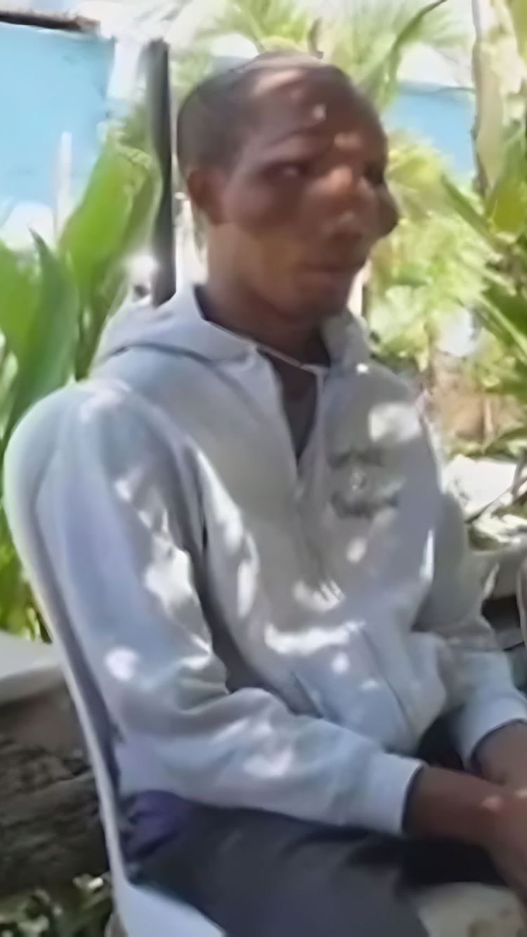 Derita Penyakit Misterius Tidak Ada Obatnya, 5 Bersaudara Ini Miliki Wajah Aneh Disebut Mirip E.T.