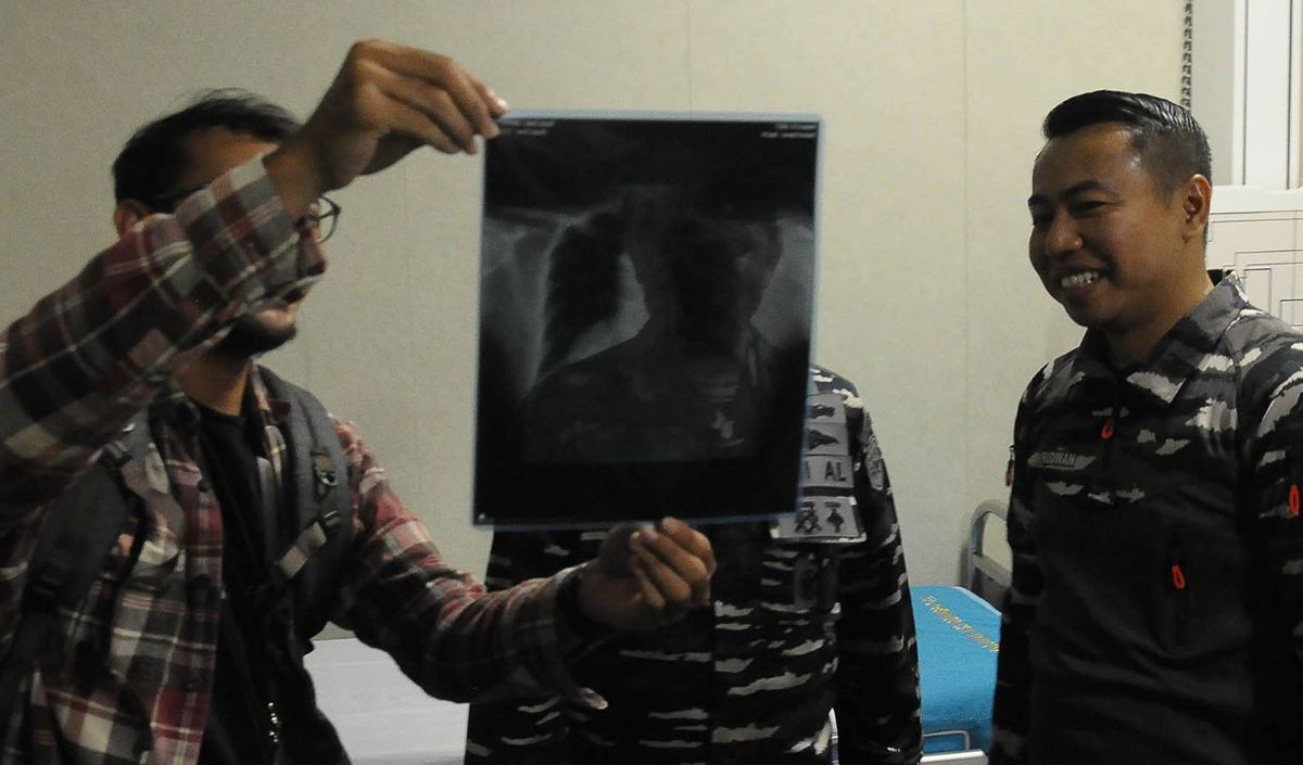 Setara RS tipe C Plus dengan Fasilitas CT Scan