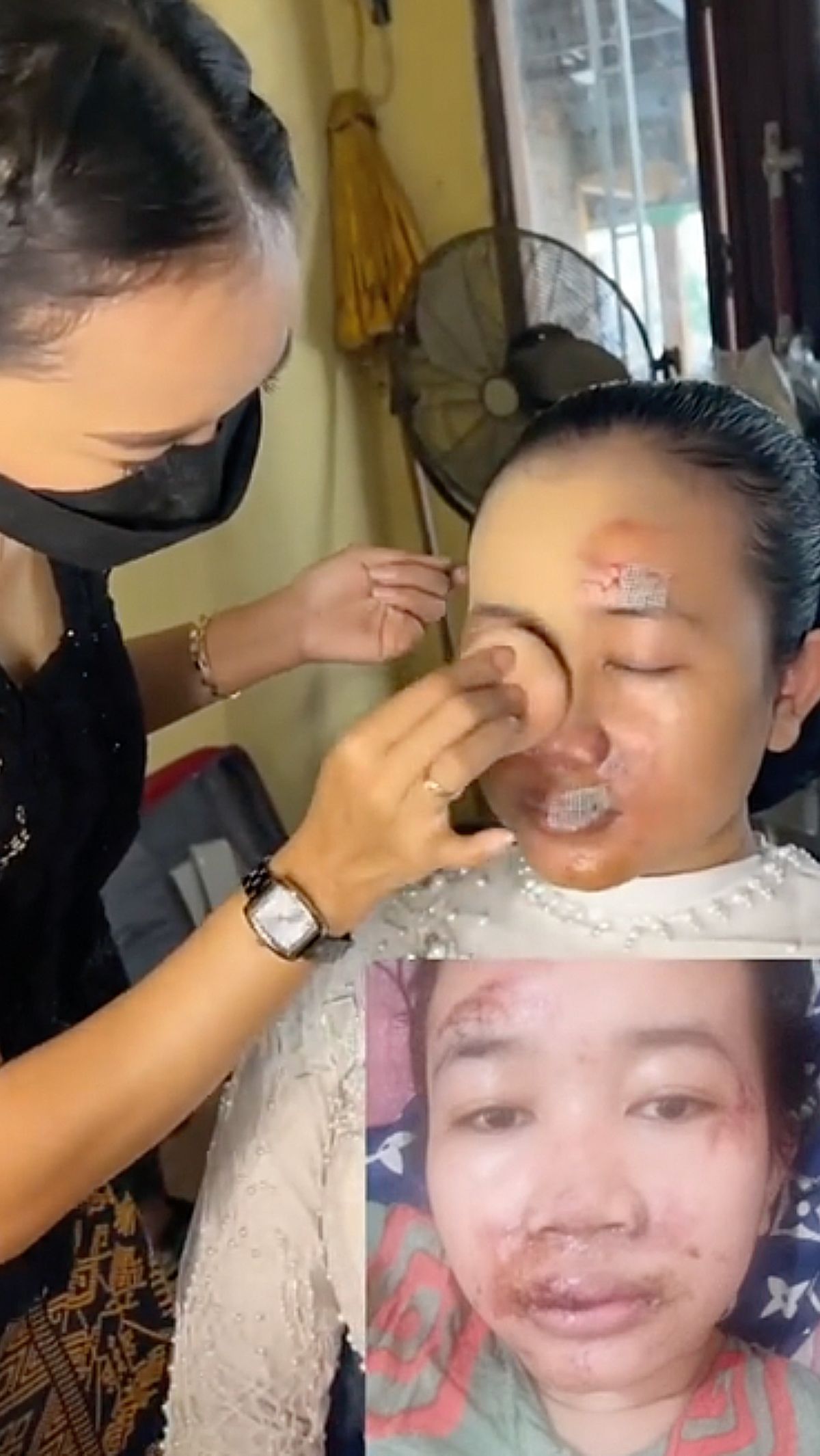 Wajah Pengantin Hancur Akibat Kecelakaan, Riasan MUA jadi 'Penyelamat' di Hari Pernikahan, Hasilnya Bikin Takjub!