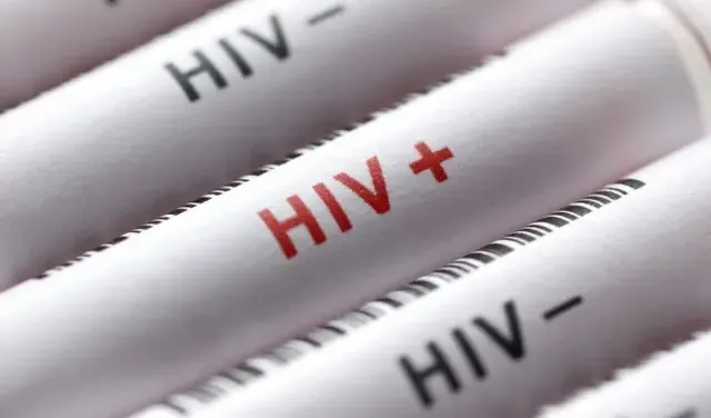 Hampir 80.000 Warga di Jakarta Tercatat Idap HIV AIDS
