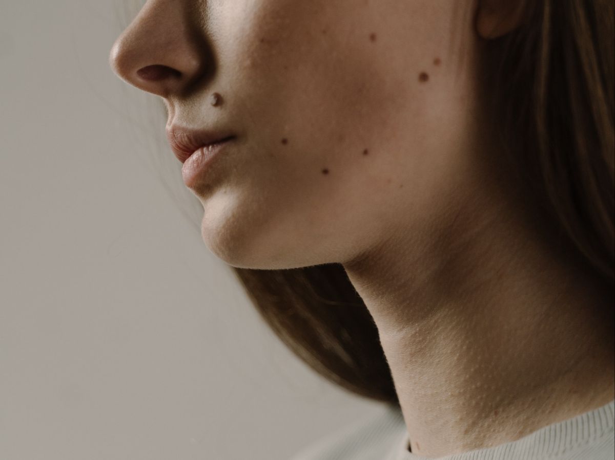 6 Arti Tahi Lalat di Wajah dan Tubuh, Ungkap Kepribadian Seseorang