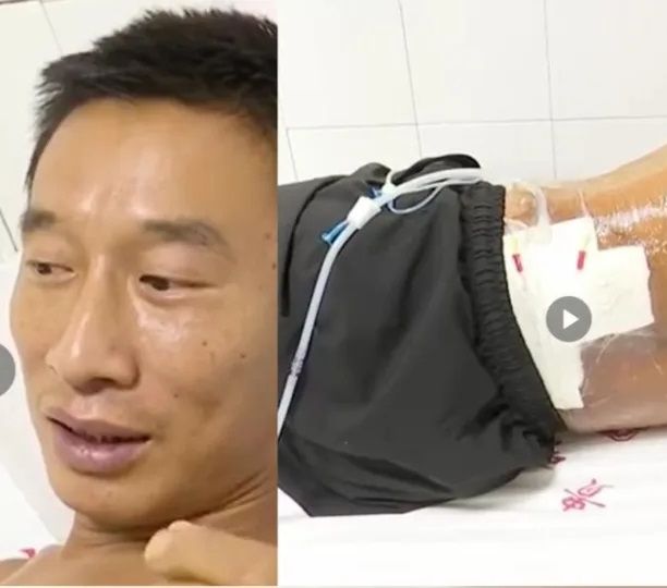 Viral Pria Tersambar Petir Dua Kali dalam 5 Menit, yang Terjadi Selanjutnya