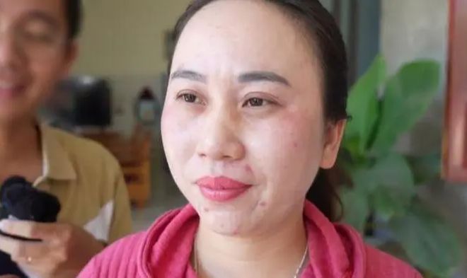 A 36-year-old Vietnamese woman claims she has been battling insomnia for 11 years.
