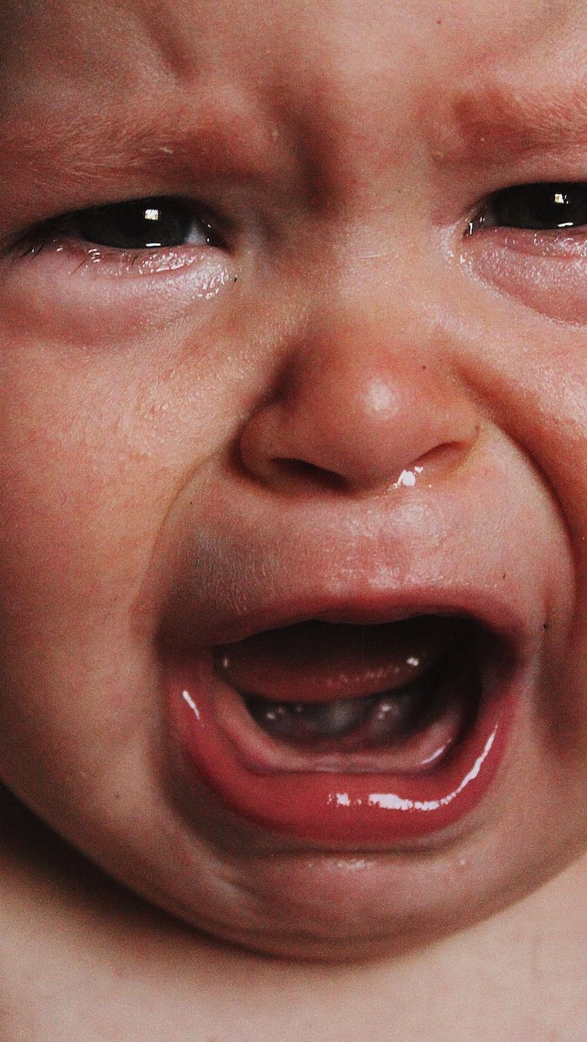 Menurut pengunggah video, bayinya yang berusia 13 bulan tersebut dikerok oleh seorang pengasuh (babysitter) menggunakan uang koin karena diduga mengalami masuk angin.