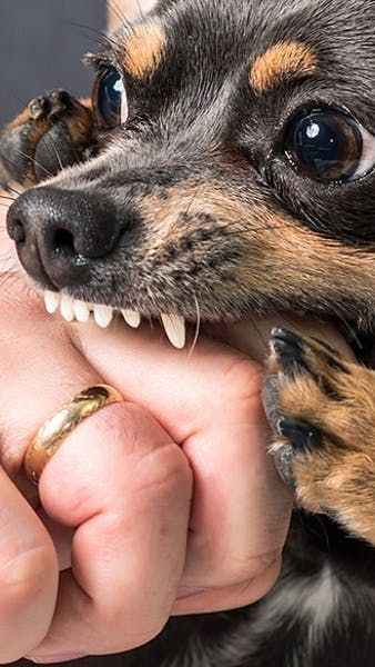 Being bitten and bleeding by your own pet dog or a dog is certainly a serious matter.