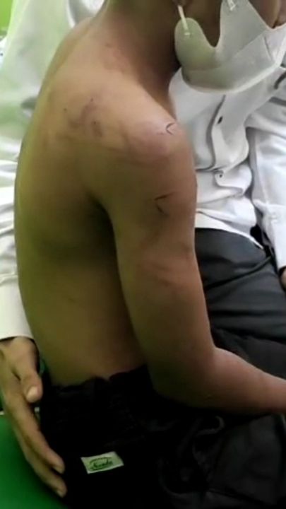 Trauma Berat, Bocah Dianiaya Ayah Kandung di Bekasi Dibawa ke Rumah Aman<br>