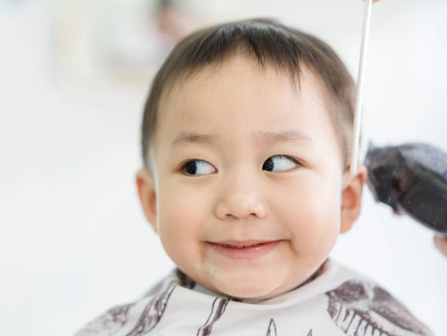 Bercak Putih di Wajah Anak Tak Selalu Panu, Bisa Karena Eksim