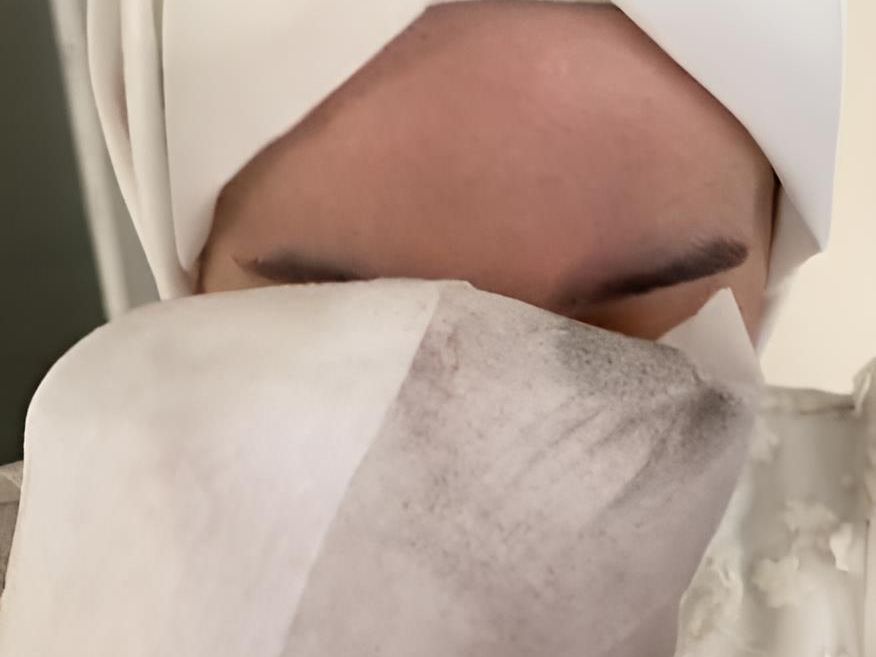 Polusi Udara Tak hanya di Jakarta! Pria Ini Kaget Lihat Tisu Bekas Mengelap Wajah Istri Berubah Hitam Usai Motoran di Bali