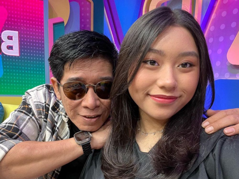 Potret Putri Bungsu Parto Patrio, Fiorelly Xavier Cantiknya Saingi Amanda Caessa