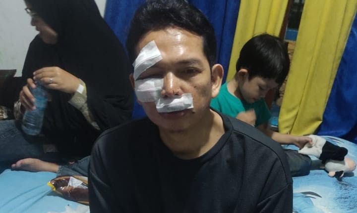 Pemotor Satu Keluarga Tertimpa Baliho Capres Rubuh di Jalan Raya Bogor, Begini Kronologinya