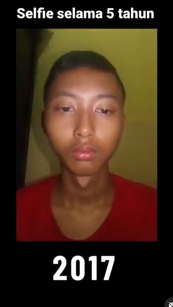 Masih Ingat Ghozali Everyday? Begini Kabarnya setelah 6 Tahun Foto Selfie Setiap Hari
