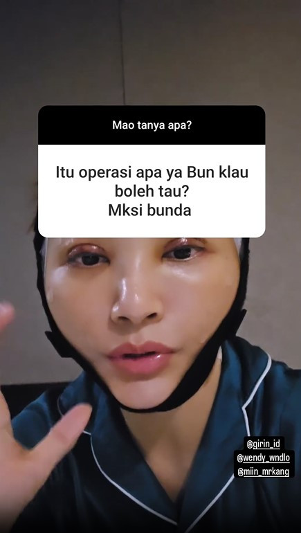 Sarwendah menjalani operasi di bagian bawah mata untuk mengambil lemak yang ada di area tersebut.