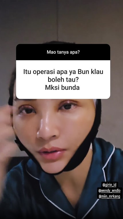 Ia juga menjalani prosedur operasi di bagian kelopak matanya yang memiliki banyak garis-garis. Selain itu kerutan dihilangkan dari wajahnya.