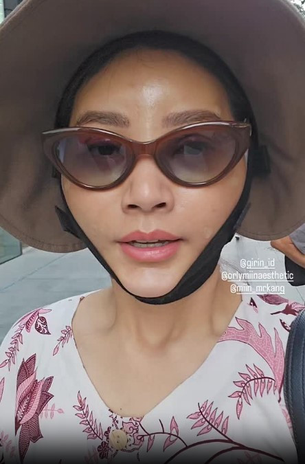 Setelah menjalani oplas, Sarwendah masih menutupinya dengan kacamata dan menyangga dagu.