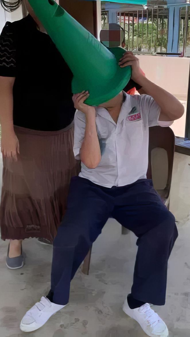 Saking Aktifnya Kepala Bocah SD Tersangkut Traffic Cone, Petugas Damkar Terpaksa Gergaji Sampai Berlubang