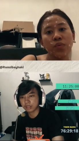 Wajahnya dipenuhi bintik putih khas Lolly anak Nikita Mirzani